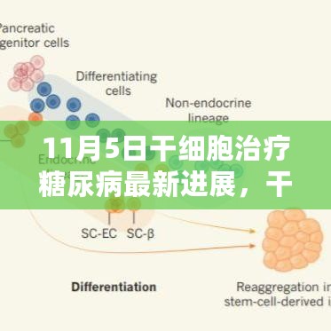 干细胞治疗糖尿病新突破，见证家庭温馨时刻的奇迹日