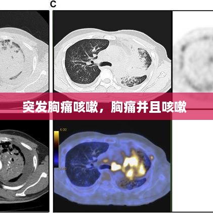 突发胸痛咳嗽，胸痛并且咳嗽 