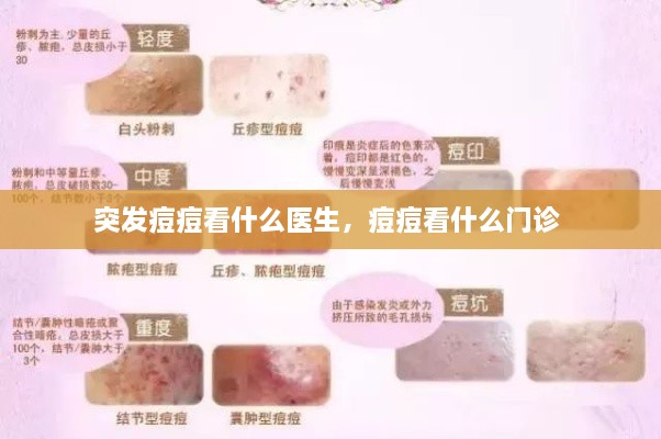 突发痘痘看什么医生，痘痘看什么门诊 